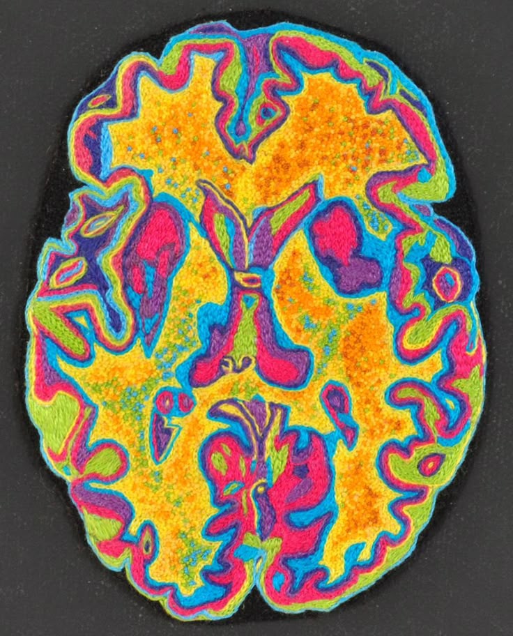 The Hidden Cause of Mental Fatigue
